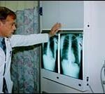 Dr. Andrew Nathanson checkingon an X-ray.