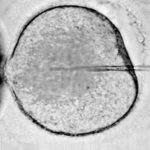 R.I. firm furthers human egg technology A microscopic view of a human egg injectedwith a cryopreservative.