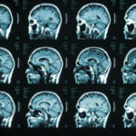 Seeing profits in MRIs Photo is a Corbis Image.