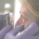 Research weds engineering, medicine PBN photo/FRANK MULLIN
The Hemacam, a device created by two Rhode Island Hospital doctors and Brown University engineers, can detect anemia by gauging the color of tissue under the eye.