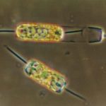TATIANA RYNEARSON, an oceanographer at the University of Rhode Island, studies the plankton species diatoms, shown above, to examine their oxygen production. / 