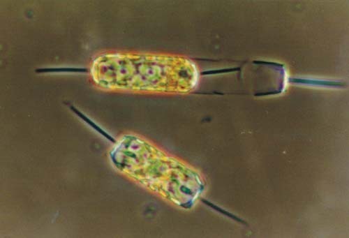TATIANA RYNEARSON, an oceanographer at the University of Rhode Island, studies the plankton species diatoms, shown above, to examine their oxygen production. / TATIANA RYNEARSON, an oceanographer at the University of Rhode Island, studies the plankton species diatoms, shown above, to examine their oxygen production. /